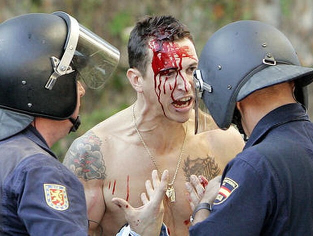 Un seguidor malaguista sufri&oacute; una brecha en la cabeza tras una carga policial.