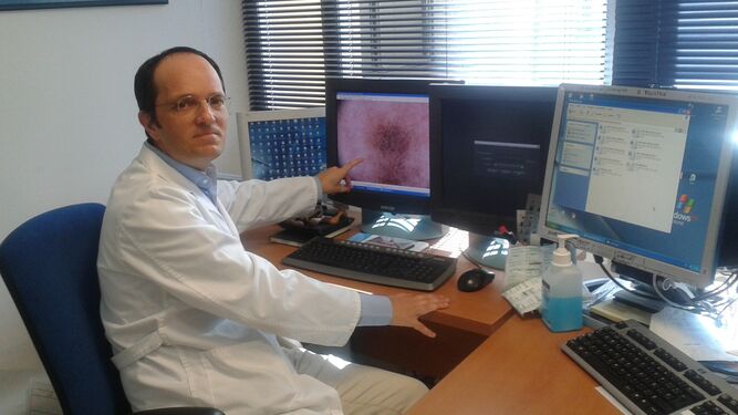 Silvestre Martínez muestra una imagen enviada desde un centro de salud dentro del proyecto de teledermatología.
