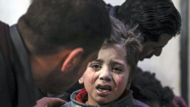Un niño herido recibe ayuda ayer en un hospital de Douma (Siria).