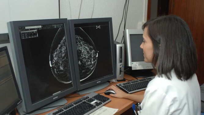 El cribado de cáncer de mama mediante mamografía es una de las herramientas que presentan controversia en este debate.