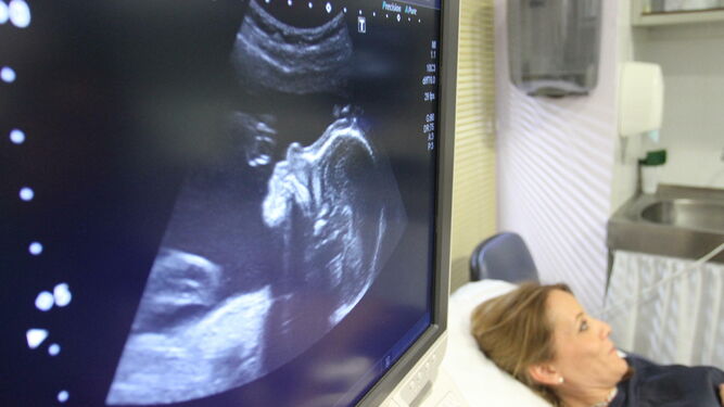 Exploración ecográfica de un feto.