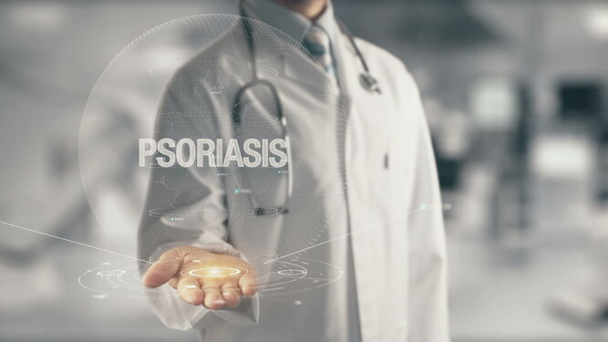 La psoriasis es una enfermedad crónica.