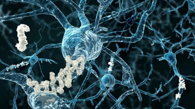 Genes 'zombis': Las células activas del cerebro después de la muerte