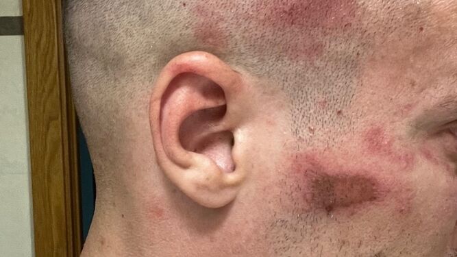 Lesiones en la cara, producidas supuestamente por la agresión de los policías.