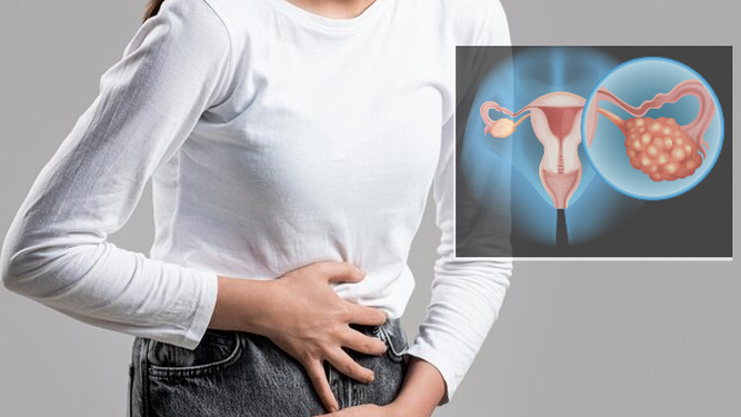 Cáncer de ovario en mujeres jóvenes: Causas y síntomas tempranos