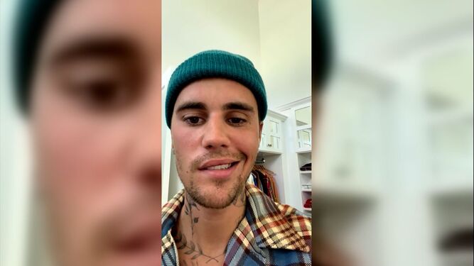 Justin Bieber en su vídeo en el que revelaba sufrir una parálisis facial