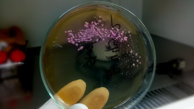 Preocupación por Candida Auris: el hongo potencialmente mortal que amenaza a los hospitales de todo el mundo