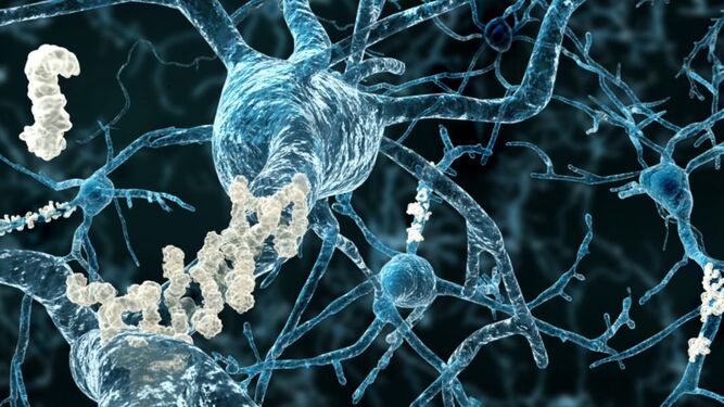 Galantamina, usos y efectos secundarios de este medicamento para el Alzheimer