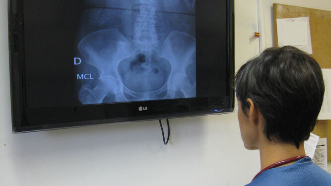 Una profesional observa una radiografía.